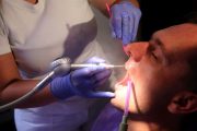 Zubarska ordinacija popravak zuba
